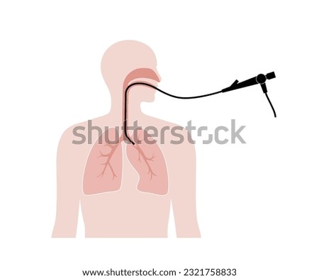 Bronchoscopy procedure. Pulmonologist uses a bronchoscope through mouth into the lung. Respiratory system diseases and treatment. Endobronchial ultrasound bronchoscopy diagnostic vector illustration.
