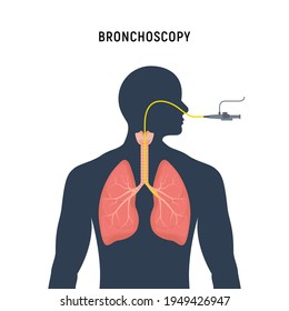 Bronchoscopy respiratory system emphysema endoscopy human lung examination. Bronchoscopy icon