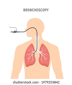 Bronchoscopy respiratory system emphysema endoscopy human lung examination. Bronchoscopy icon