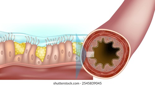 Brônquio. Ilustração médica representando cílios e muco respiratórios. Epitélio colunar pseudoestratificado. Infográficos de Epitélio Ciliado Estrutural 