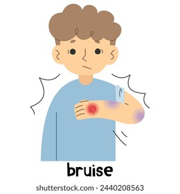 Bruise 1 cute on a white background, vector illustration.