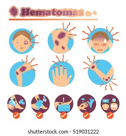 Bruises on the skin and body care.
vector illustrations