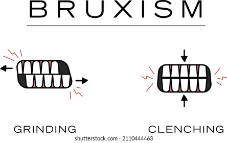 Bruxism Teeth Grinding Teeth Clenching Simple Minimalist Dental Health Doodle Illustration