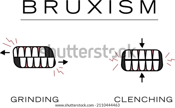 Bruxism Teeth Grinding Teeth\
Clenching Simple Minimalist Dental Health Doodle\
Illustration