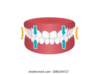 Bruxism Vector Illustration | Clenching Teeth