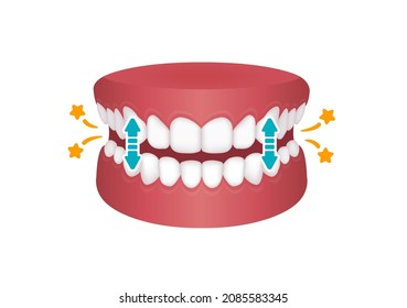 Bruxism vector illustration | tapping teeth