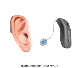 BTE divices with an external receiver. Hearing aid behind the ear. Treatment and prosthetics in otolaryngology. Realistic Vector illustration