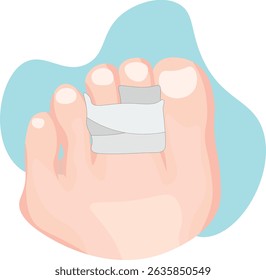  buddy splint is a simple orthopedic device used to immobilize and support an injured finger or toe by taping it alongside an adjacent healthy digit