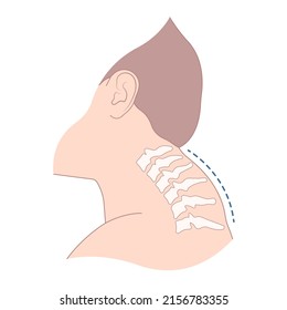 Símbolo anormalmente curvo de la anatomía del cuello