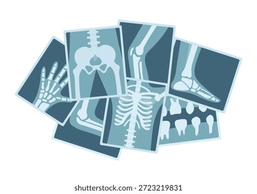 Un montón de Imágenes de rayos X de varias partes del cuerpo humano sobre un fondo blanco. Concepto de diagnóstico óseo humano. Elementos de Medicina.