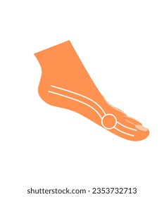 bunion on the leg. seen from the side of the bunion