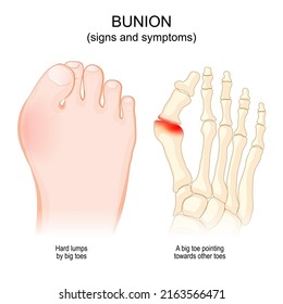 Bone Anatomy Structure Long Bone Illustration Stock Illustration ...