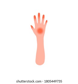 Burn of hand, icon isolated on white background. Red area, pain from flame. Cartoon realistic style. Vector illustration.