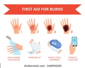 Burn skin. First treatment human hand fire or chemical destruction injury graviera skin safety for persons vector infographics