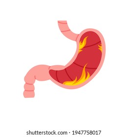 Burn in stomach flat cartoon illustration. Gastric problem symptoms banner design. Digestive Healthcare background