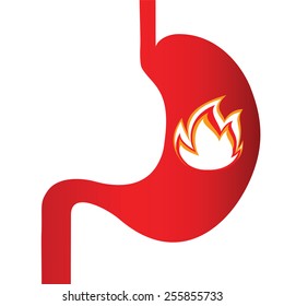 burning sensation in the stomach