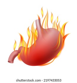 Burning stomach. Realistic human organ of internal digestion system on fire. Heartburn digestive, gastric pain or esophagus. Vector illustration