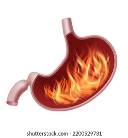 Brennender Magen. Realistisches menschliches Organ des inneren Verdauungssystems auf Feuer. Magenschmerzen oder Ösophagus. Vektorgrafik