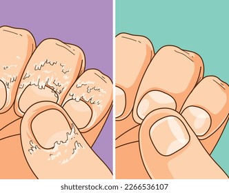 Burrs. Damaged skin. Before, after. Healthcare illustration, vector illustration. 