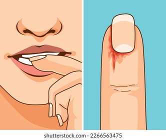Burrs. Burrs danger. Bite the burrs. Damaged skin. Bleeding wound. Bad habit. Healthcare illustration, vector illustration. 