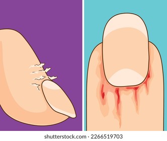 Burrs. Burrs danger. Damaged skin. Bleeding wound.  Healthcare illustration, vector illustration. 