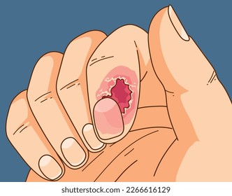 Burrs. Burrs danger. Damaged skin. Bleeding wound.  Healthcare illustration, vector illustration. 