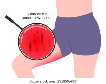 Bursitis fracture in plexus flexion muscle with groin strain thigh pain injury or hip lumbar rotation back and Obturator nerve externus lower the first aid of RICE Rest Ice stress torn