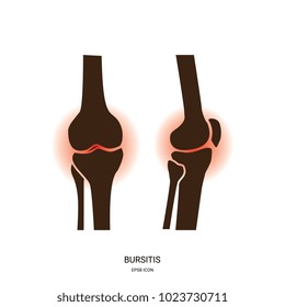 Bursitis and Knee Joint Icon. Human Bones Joint Symbol for Medical Apps and Websites