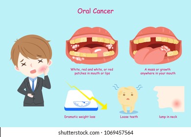 businessman with oral cancer on the blue background