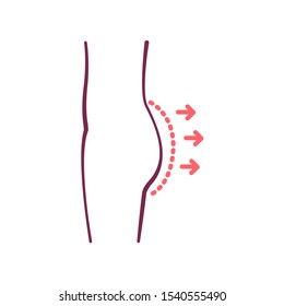 Buttock augmentation color line icon. Gluteoplasty concept. Correction female figure. Plastic body surgery. Sign for web page, mobile app, banner, social media. Editable stroke.