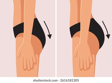 
Buttock Augmentation Surgery Before and After Vector Illustration. Results of the transformation after a cosmetic procedure called bbl 

