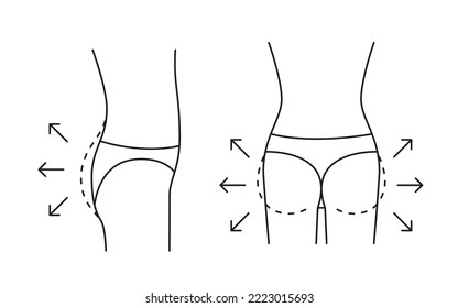 Buttock increase of woman, shape butt with arrow and contour, line icon. Augmentation flat, reshape buttocks. Cosmetic medical procedures, clinic of plastic surgery. Vector outline illustration