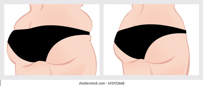buttocks before and after weight loss. Vector image on a white background. Scroll down to see more of my designs linked below.