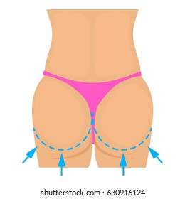 Buttocks plastic correction icon. Cartoon illustration of buttocks plastic surgery correction vector icon for web