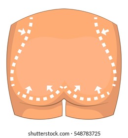 Buttocks surgery correction icon. Cartoon illustration of body surgery correction vector icon for web design