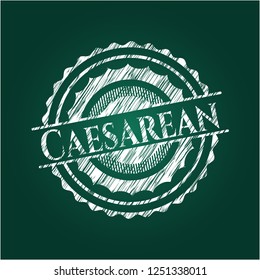 Caesarean on chalkboard