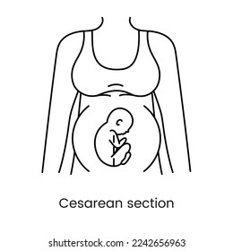 La sección cesárea ve la línea de iconos en vector, ilustración de una mujer embarazada.