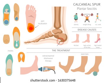 calcaneal spur left foot