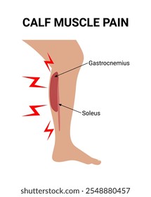 Ilustración vectorial del dolor muscular de la pantorrilla