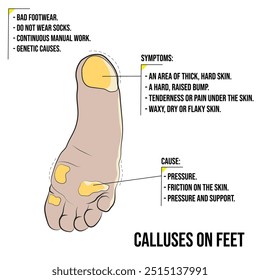 Calos nos pés, pele espessa em um lado do pé.