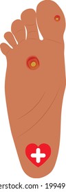 calluses on the heel of the foot and a red heart with a white cross