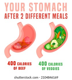 Calorie density. What 400 calories look like in the stomach. Vertical medical poster. Colorful infographic. Healthy eating concept. Editable vector illustration isolated on a white background.