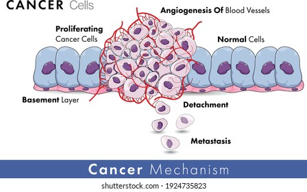 Cancer Cell Development Entire Mechanism Including Angiogenesis, Metsatsis, And Proliferation With Normal Cells In The Background And Basement Membrane Vector Graphic Design