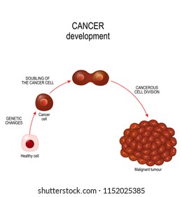 Cancer cell. illustration showing cancer disease development. Vector diagram for your design, educational, science and medical use