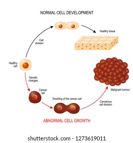 Cancer Cell And Normal Cell. Healthy Tissue And Malignant Tumour. Illustration Showing Cancer Disease Development. Vector Diagram For Your Design, Educational, Biological, Science And Medical Use