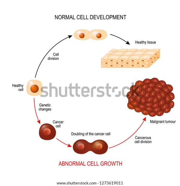 Cancer Cell Normal Cell Healthy Tissue Stock Vector (Royalty Free ...