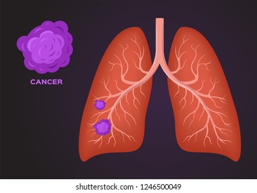 246 Epithelial cells in lungs Images, Stock Photos & Vectors | Shutterstock