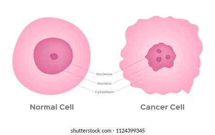 cancer cell stage and development vector