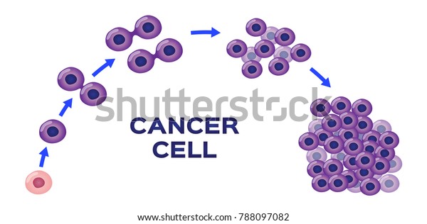 cancer cell stage and\
development vector