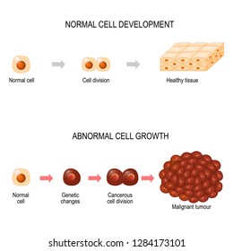 Cancer cells. illustration showing cancer disease development. Healthy tissue and Malignant tumour.  Vector diagram for your design, educational, biological, science and medical use